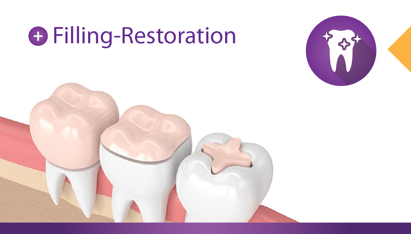 FillingRestoration cases Infinity Dental Associates