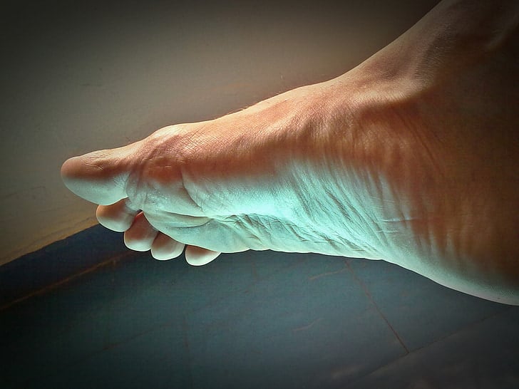 Do You Have A High Foot Arch? Physioroom Advice