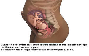 Infogen Cuales Son Los Sintomas Tempranos De Una Muerte