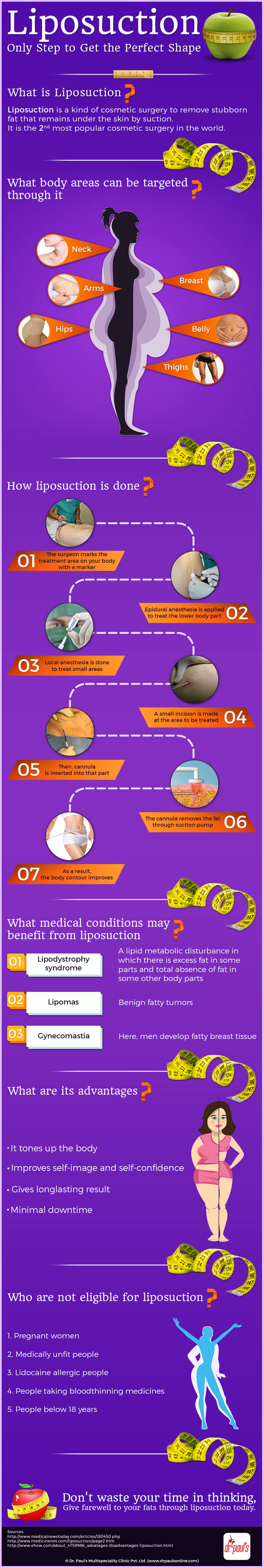 Liposuction One Step to Get the Perfect Shape [INFOGRAPHIC]