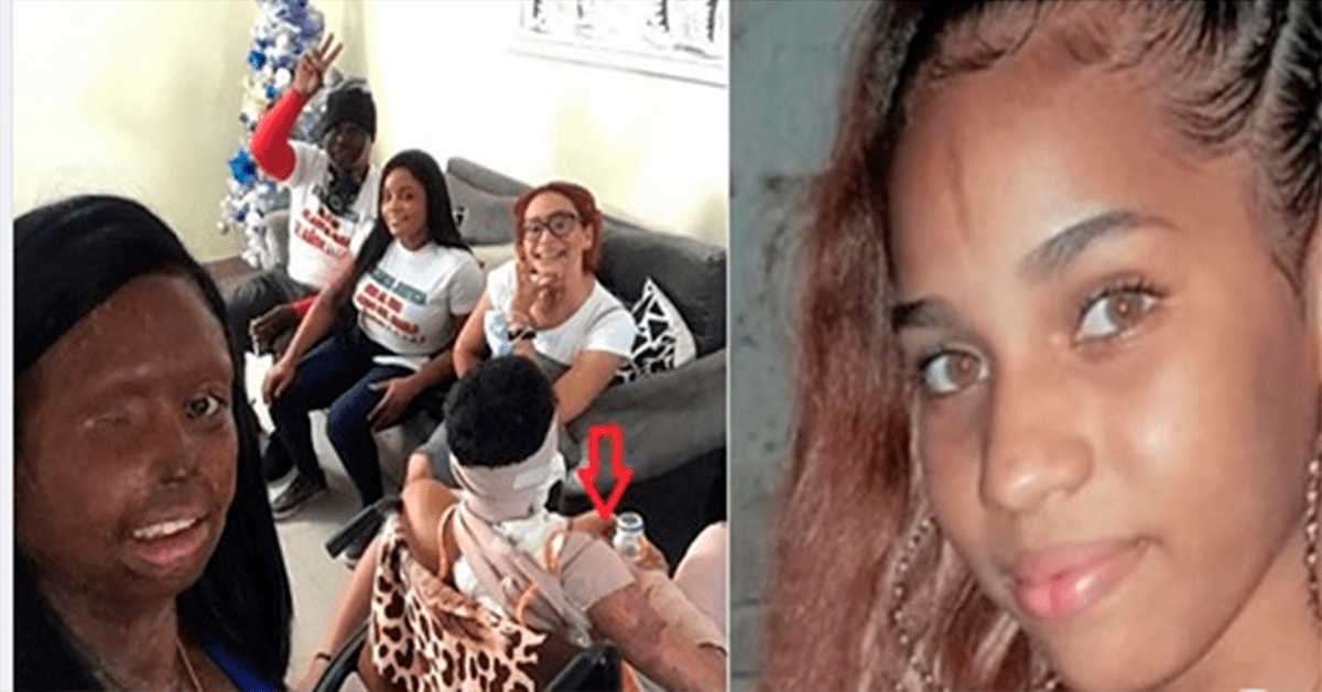 Esther Jiménez visita a Yocairi Amarante. Informe RD