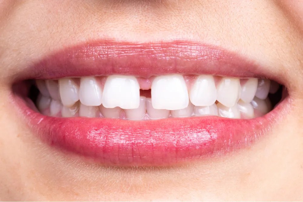 Best Orthodontics inSalinas MI Orthodontics Salinas MI