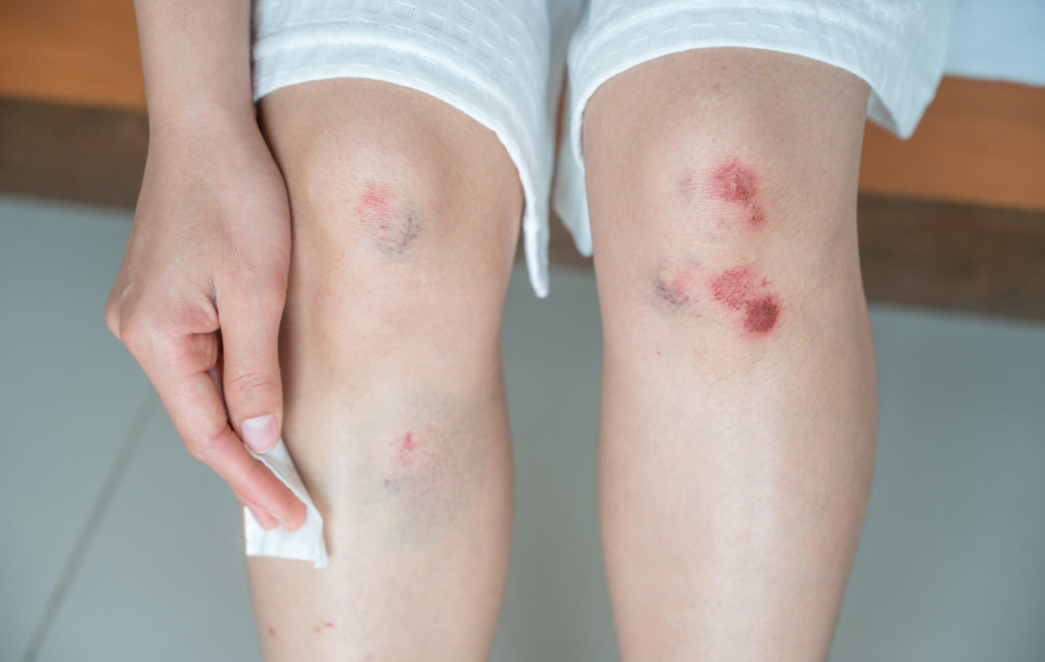 Soft Tissue Injury & Settlement Guide **[IAG's 2021 Update]**