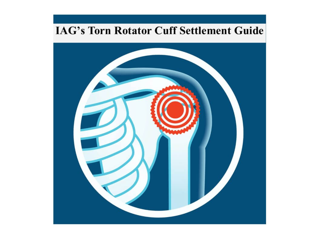 Torn Rotator Cuff Settlement Value **[4 Sample Verdicts]**