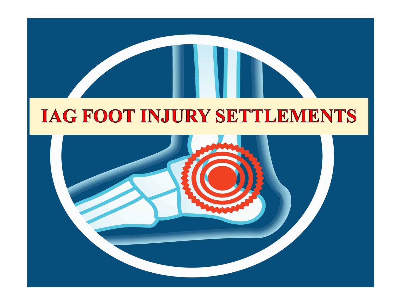 Foot Injury Lawsuit Settlements by Los Angeles Lawyer *(2021)*