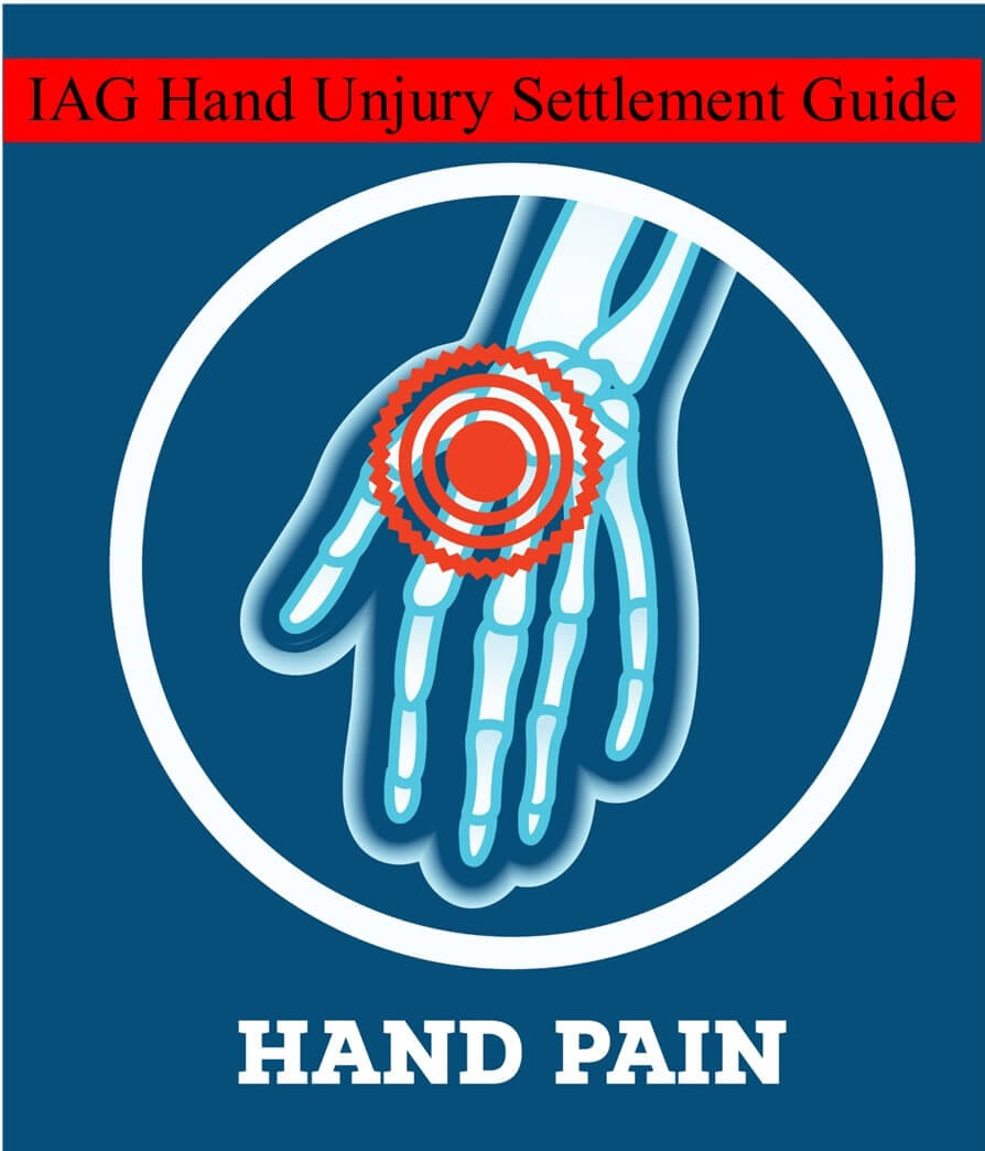 Hand Injury Settlement Guide ***(2022 Update)***