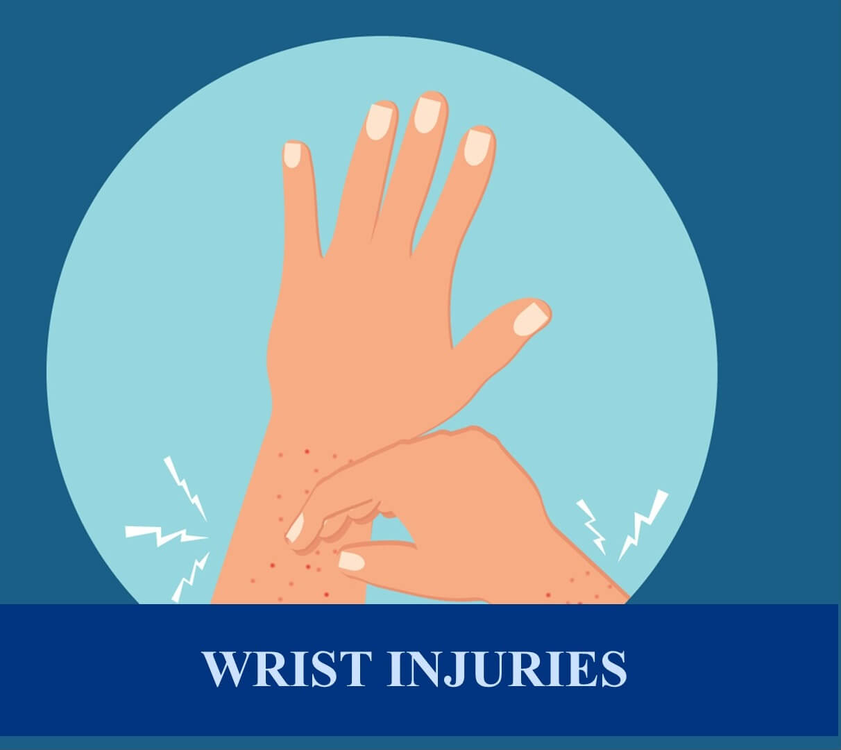 Car Accident Broken Wrist Settlement Guide **(2022 Update)**
