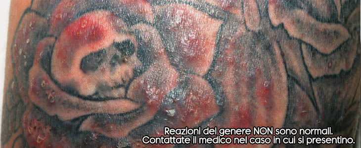 Cura Del Tatuaggio - La Guida Completa Passo Per Passo 300_x_730_jpg