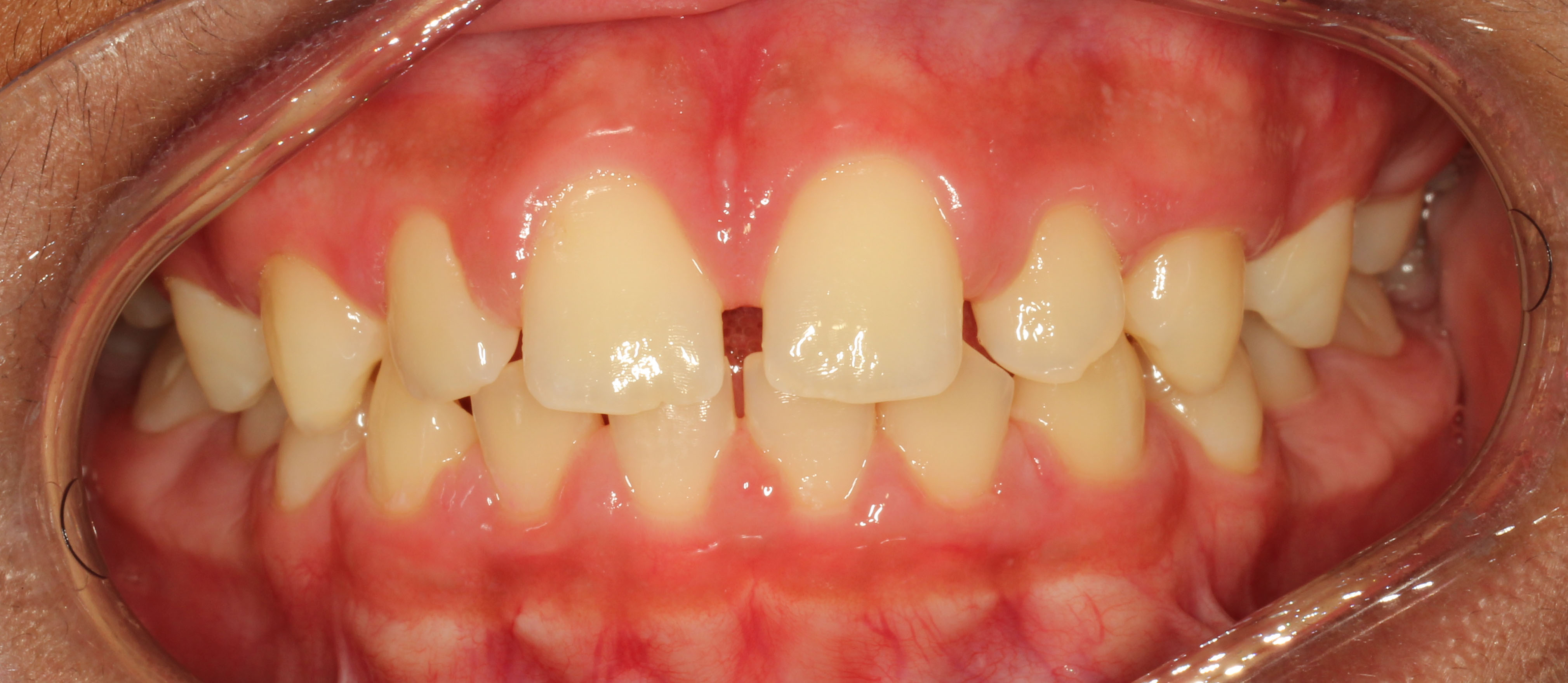 Problems Inline Orthodontics