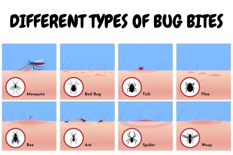 Different Types of bug bites and How to treat them