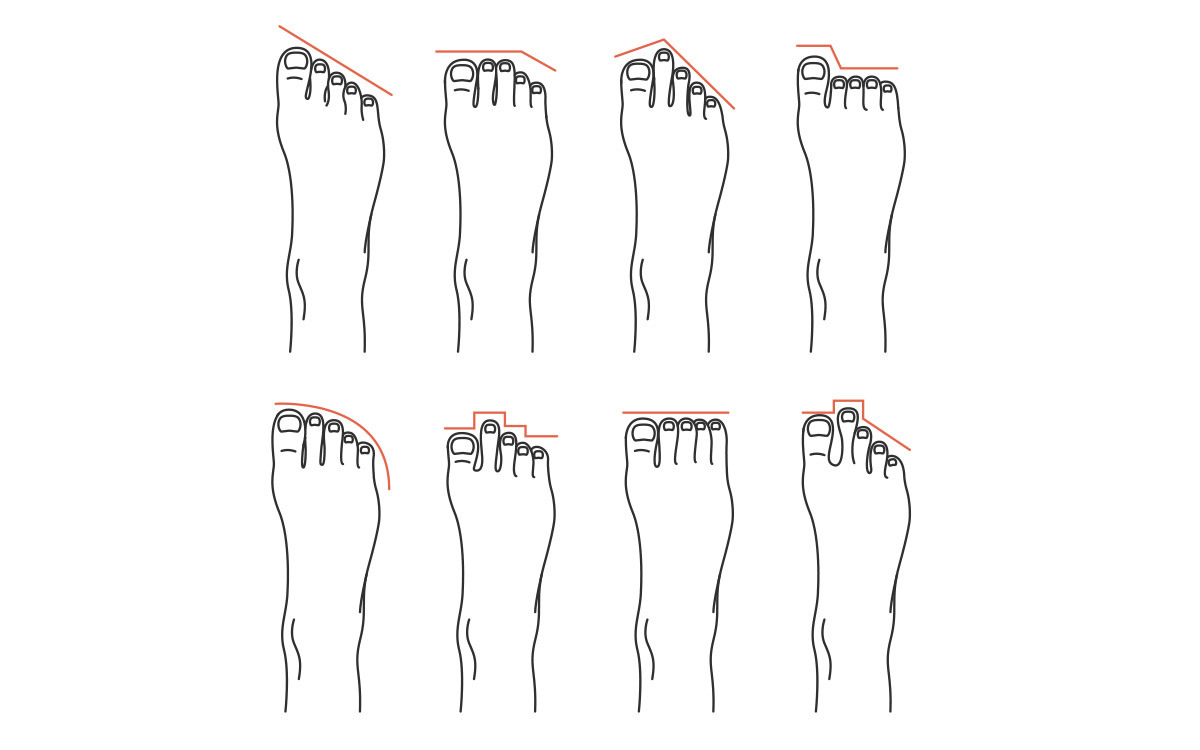 Fitting Ergonomic Insoles to Foot Shapes INSITE Insoles