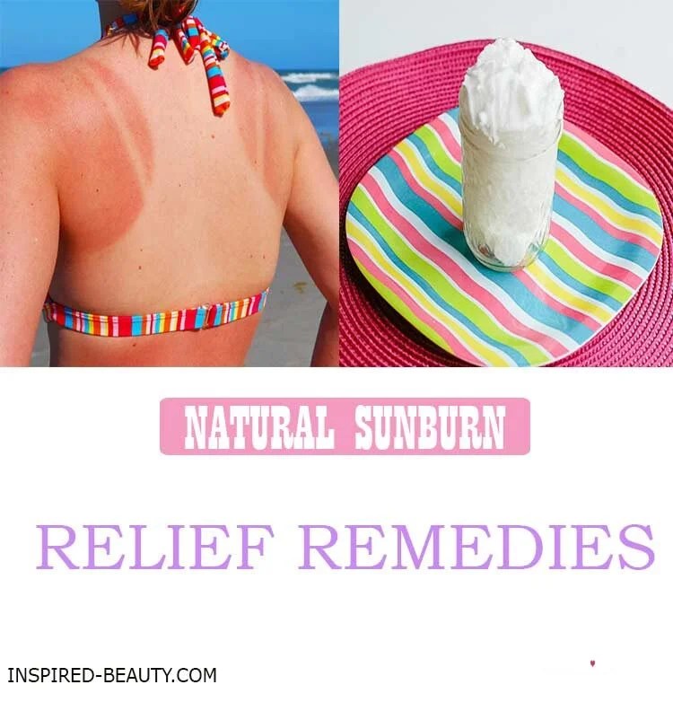 Instant Sunburn Relief at Home Inspired Beauty