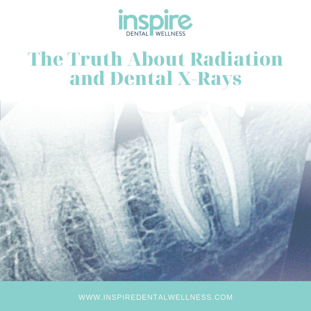 Orland Park Dentist The Truth About Radiation And Dental XRays