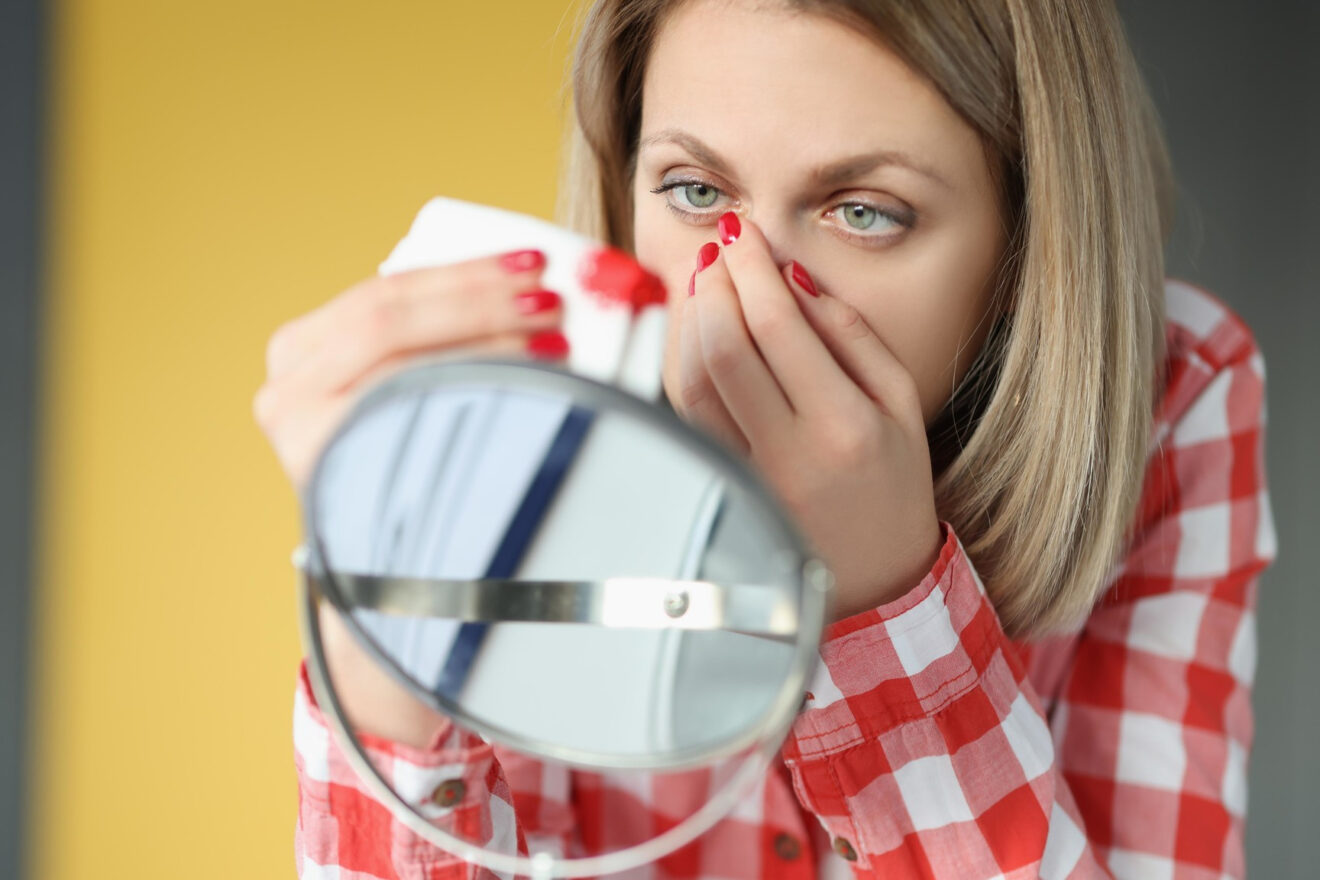 How to stop a nosebleed what to do with nosebleeds, first aid