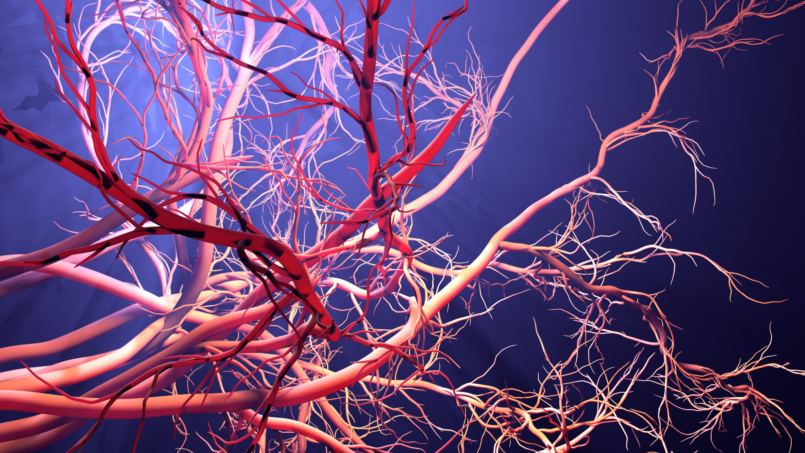 New blood vessel formation Peter Brukasz MD Addison, IL Palos New blood vessel formation Peter Brukasz MD Addison, IL Palos