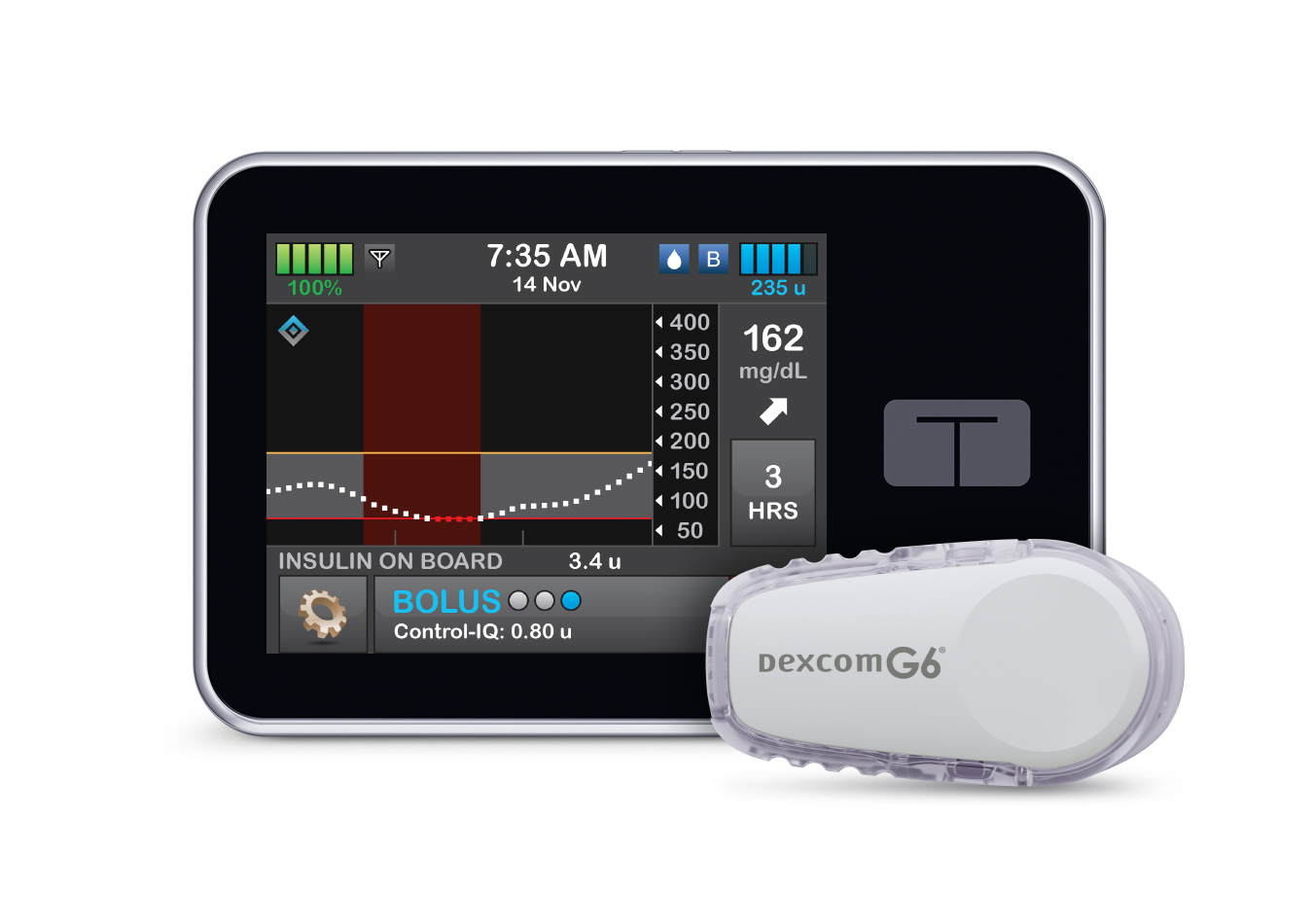 Indepth on Tandem's Advanced Hybrid ClosedLoop System Insulin Nation