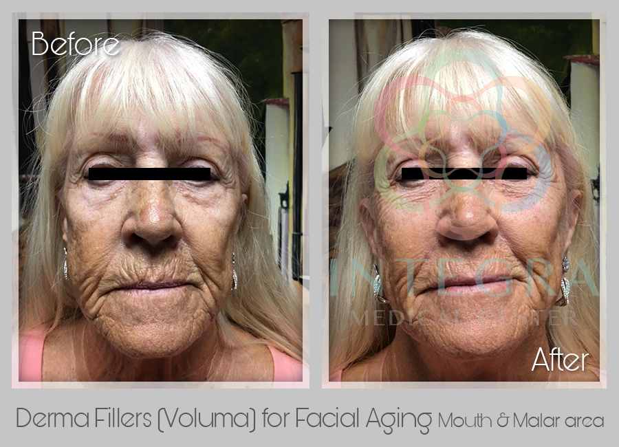 Cosmetic Surgery in Mexico Integra Medical Center