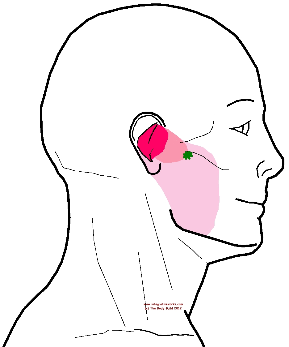 Trigger Points Earache and Jaw tension Integrative Works