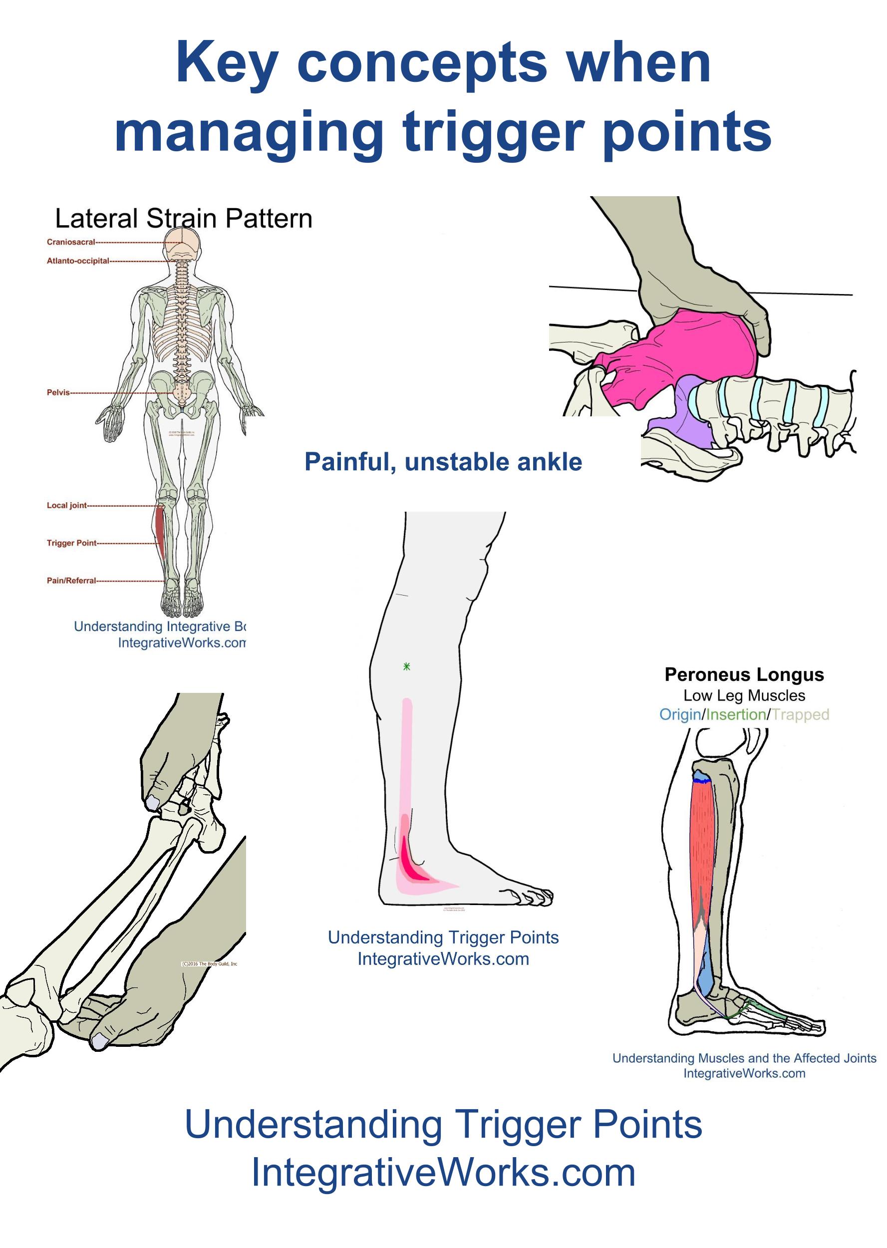Key concepts when managing trigger points Integrative Works