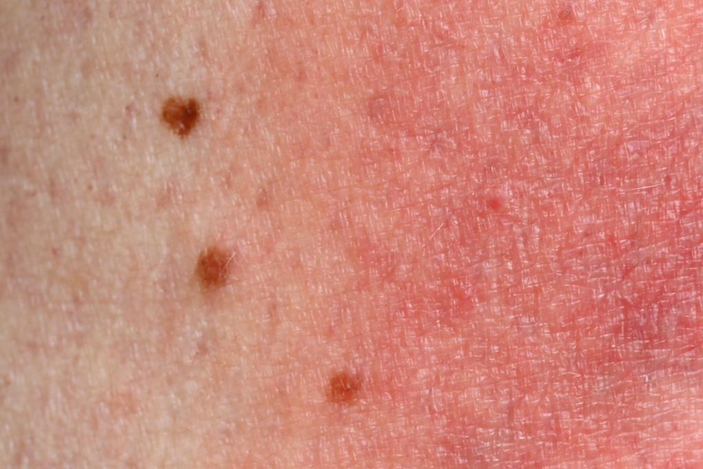 Skin Conditions Integrity Paramedical Skin Practitioners