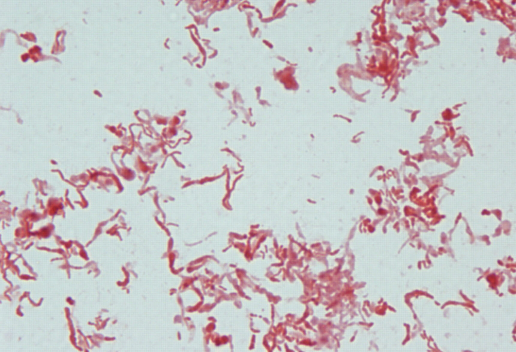 Diseases from Rats Symptoms & Treatments Integrum