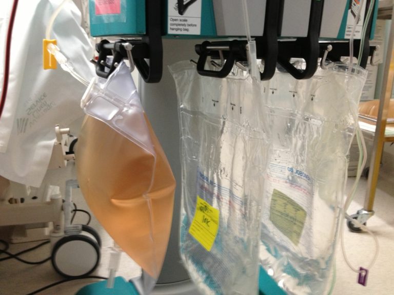 effluentbageverythingecmo004 INTENSIVE