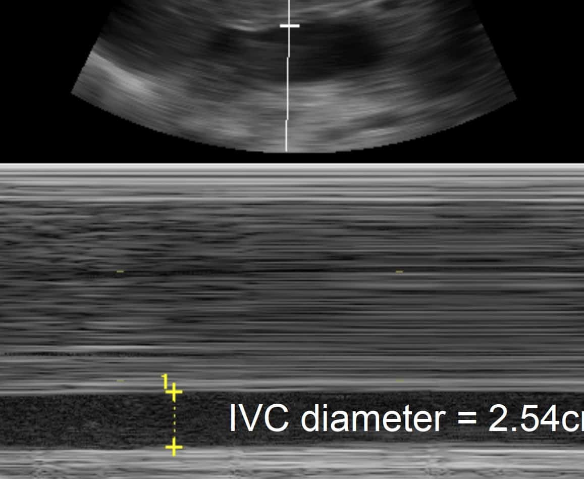 6 The Pericardium PreReading for FCUS Course Intensive Care Network