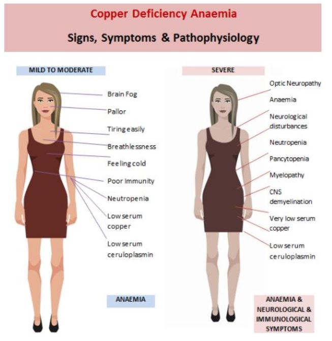Anaemia and the Copper Deficient Patient Symptoms