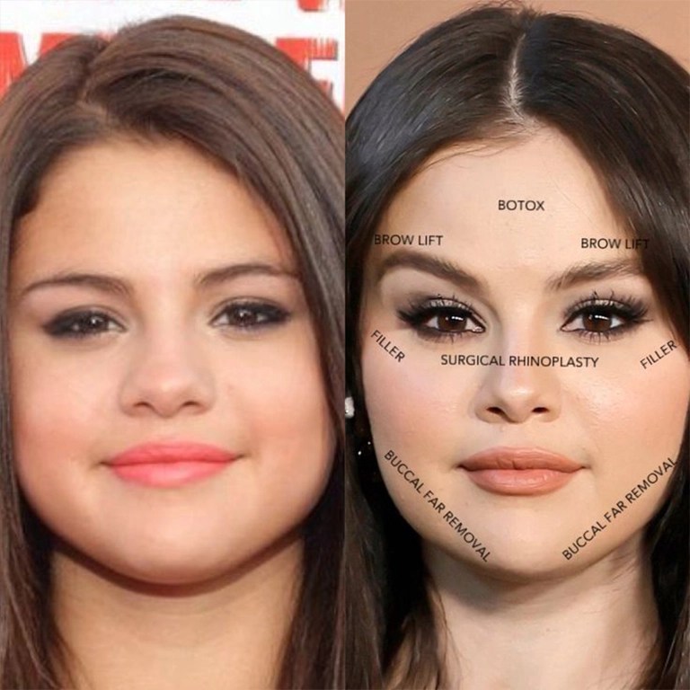 Selena Gomez Then And Now