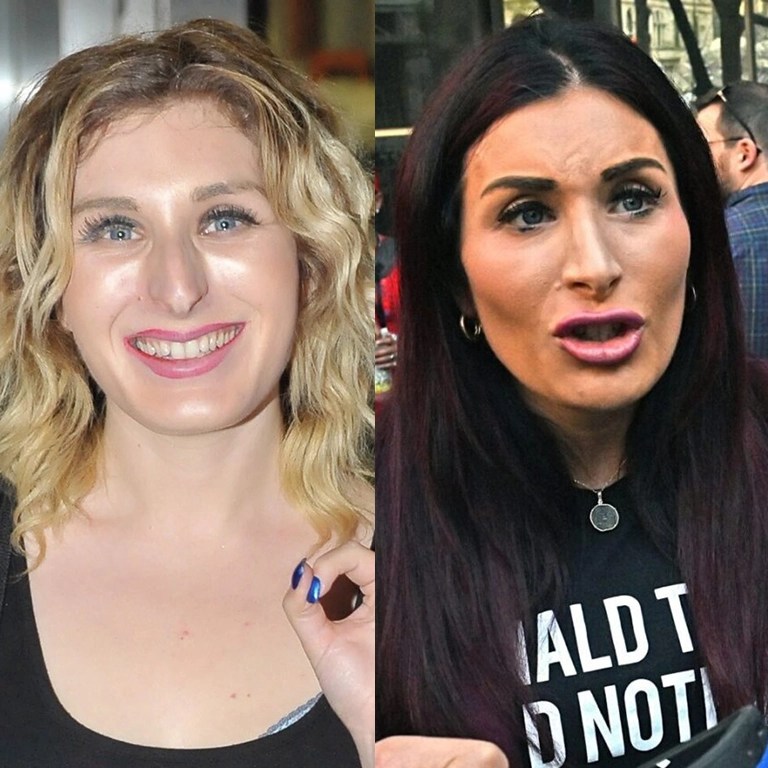 Laura Loomer Plastic Surgery International Plus