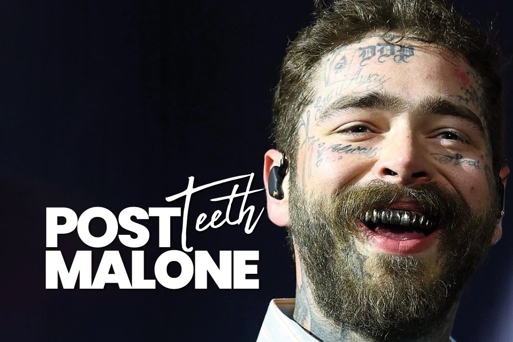 Post Malone Teeth International Plus