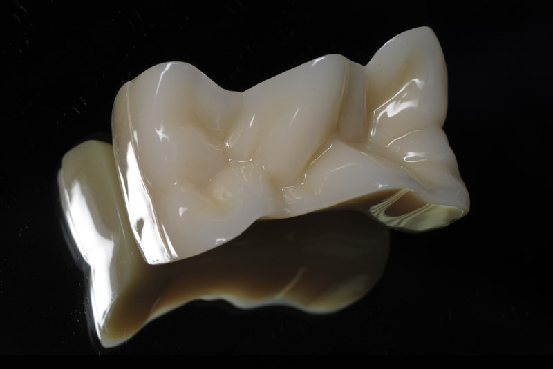 Ceramic InterPro Dental Lab