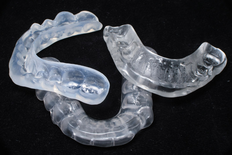 Splints & Nightguards InterPro Dental Lab