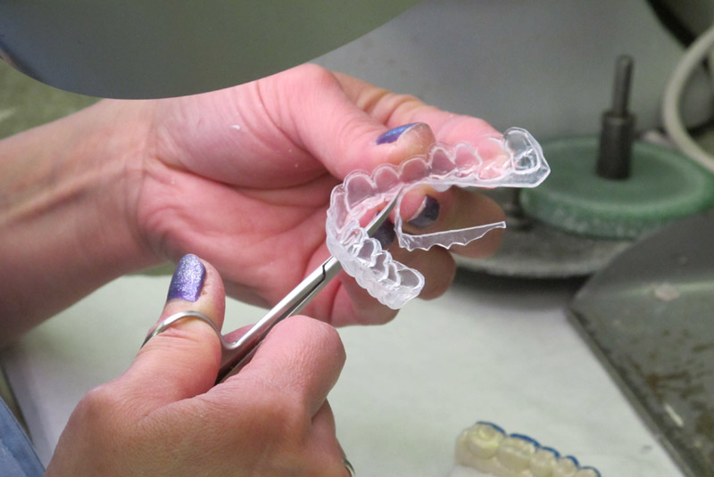 Sports Guards & Bleaching Trays InterPro Dental Lab