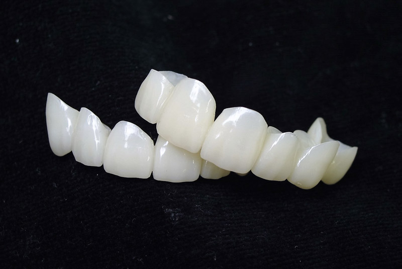 Provisionals InterPro Dental Lab