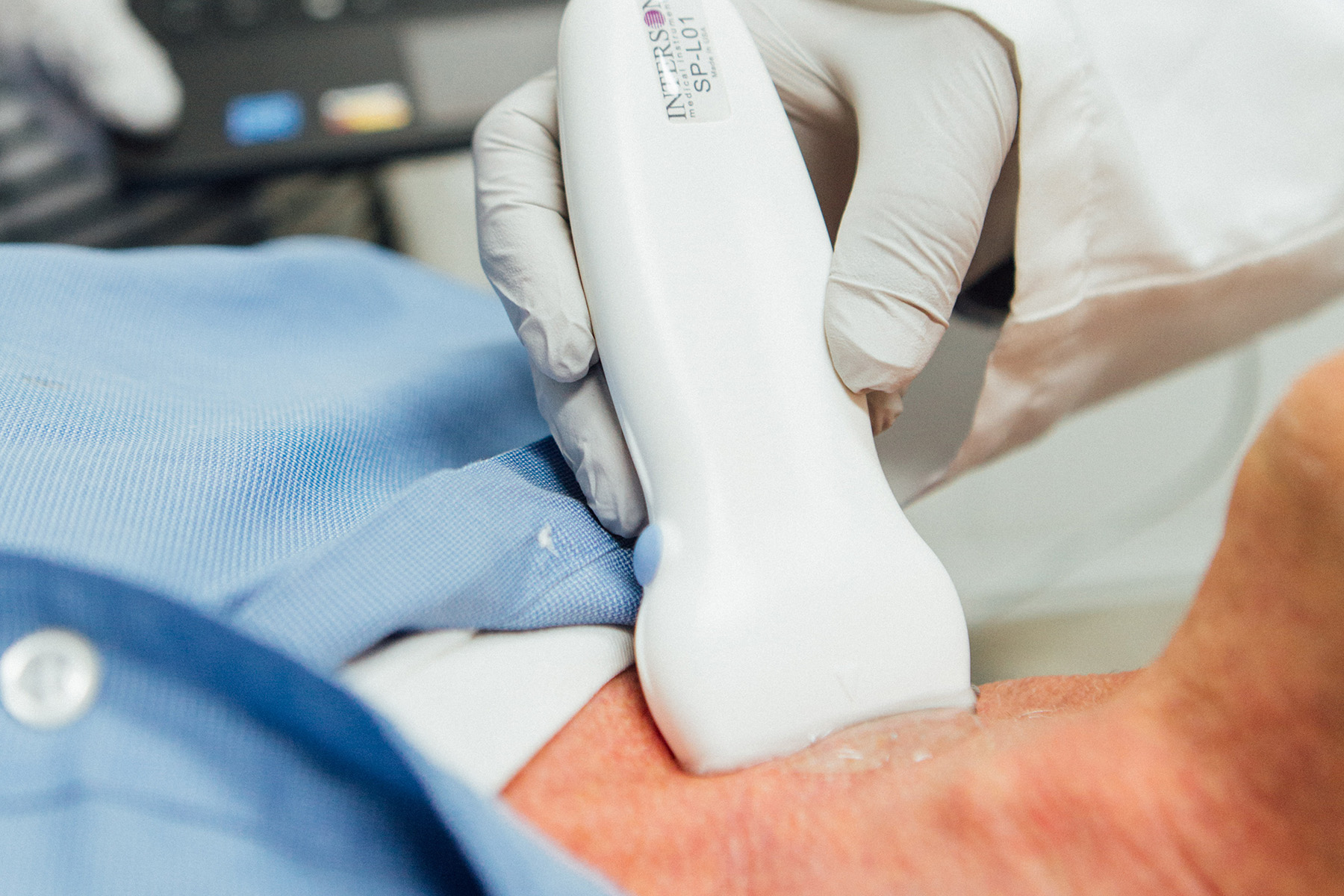 PointofCare USB Ultrasound for Small Parts Medical Imaging