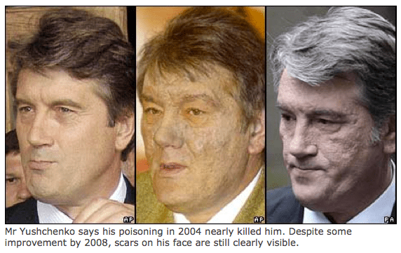 Dioxin toxicity and chloracne in the Ukraine PubMed