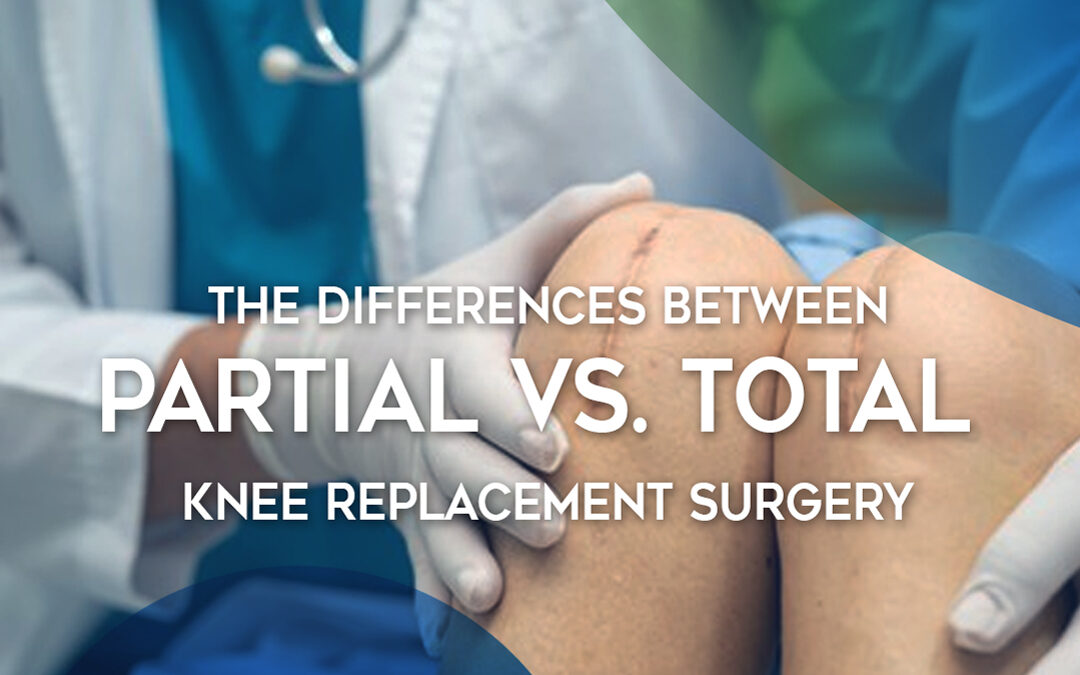 What To Expect 5 Months After Knee Replacement