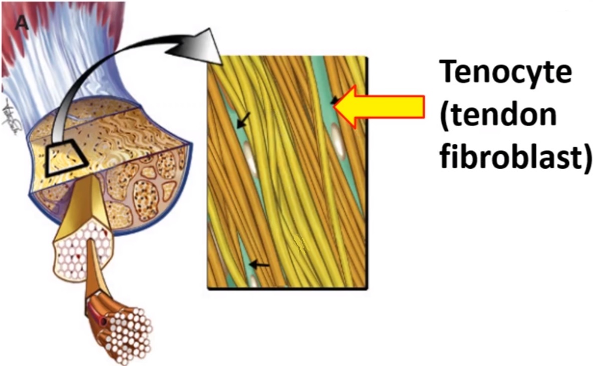 IPA Physio Photobiomodulation Tendinitis or Tendinosis?