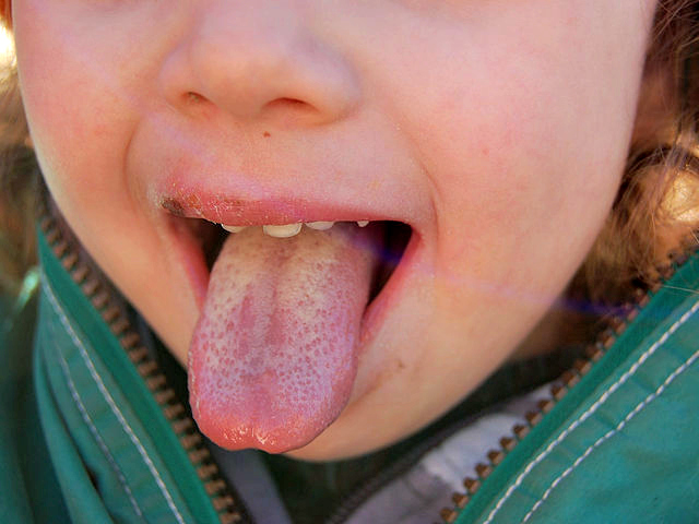 Link 37 If a Tibetan Sticks His Tongue out at You, He’s