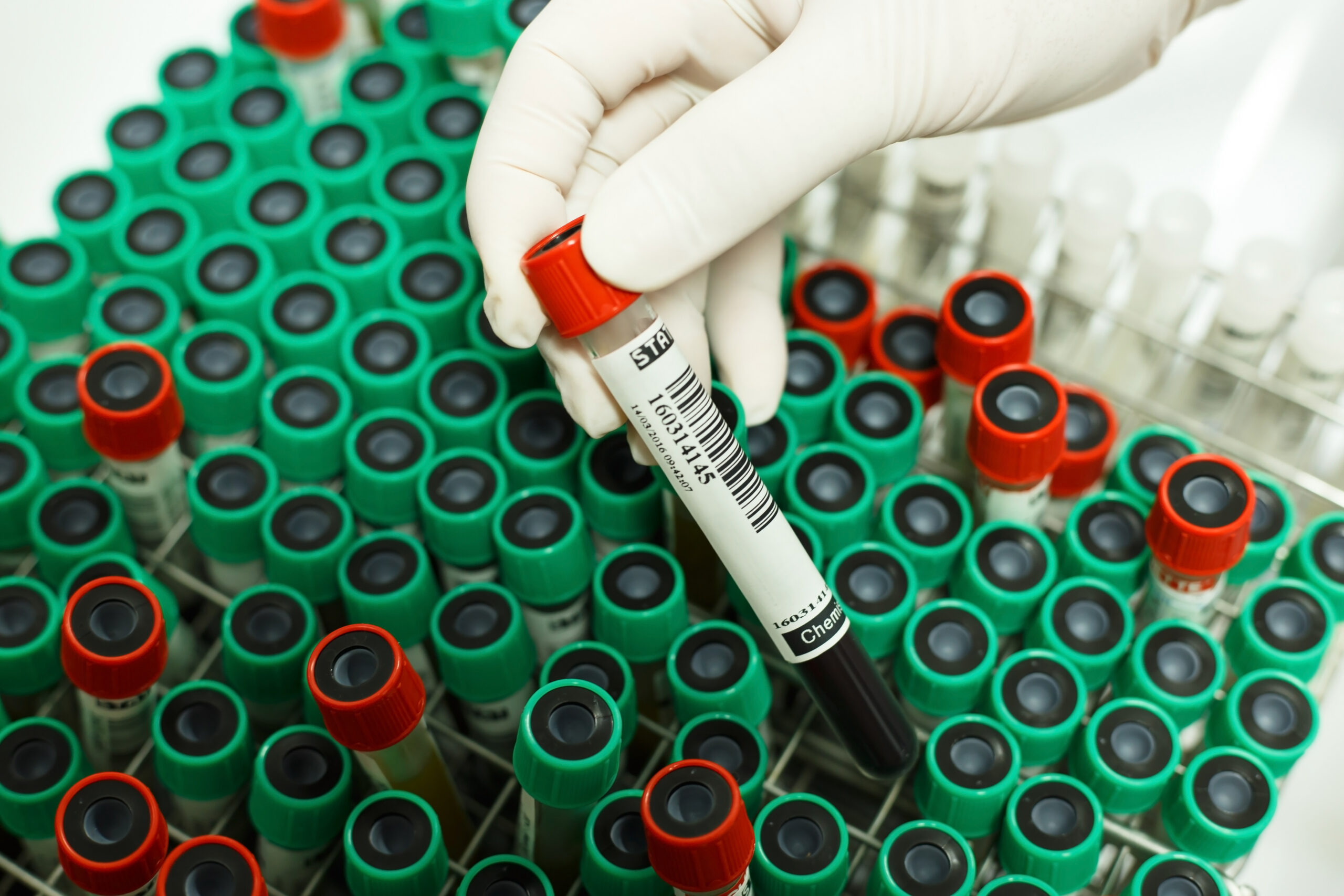 How Human Specimen Quality Can Impact Your Research iProcess