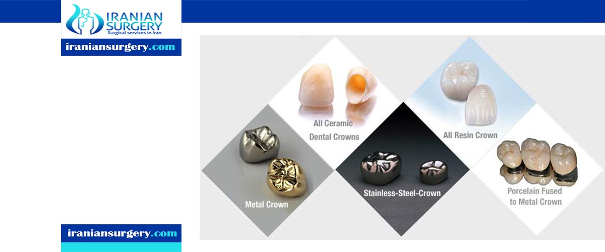Common Materials Used for Making Dental Crowns Iranian Surgery