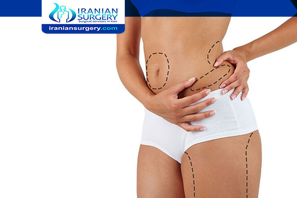 Pain After Liposuction Flanks Liposuction Flanks Recovery Liposuction Flanks