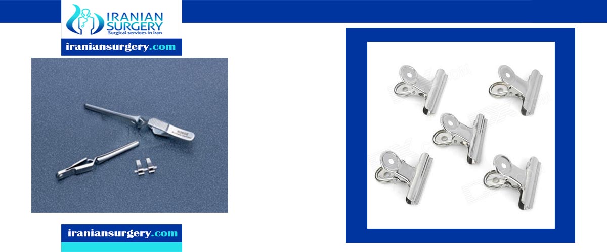 Cleft lip surgery in Iran Cleft lip surgery cost Iranian Surgery