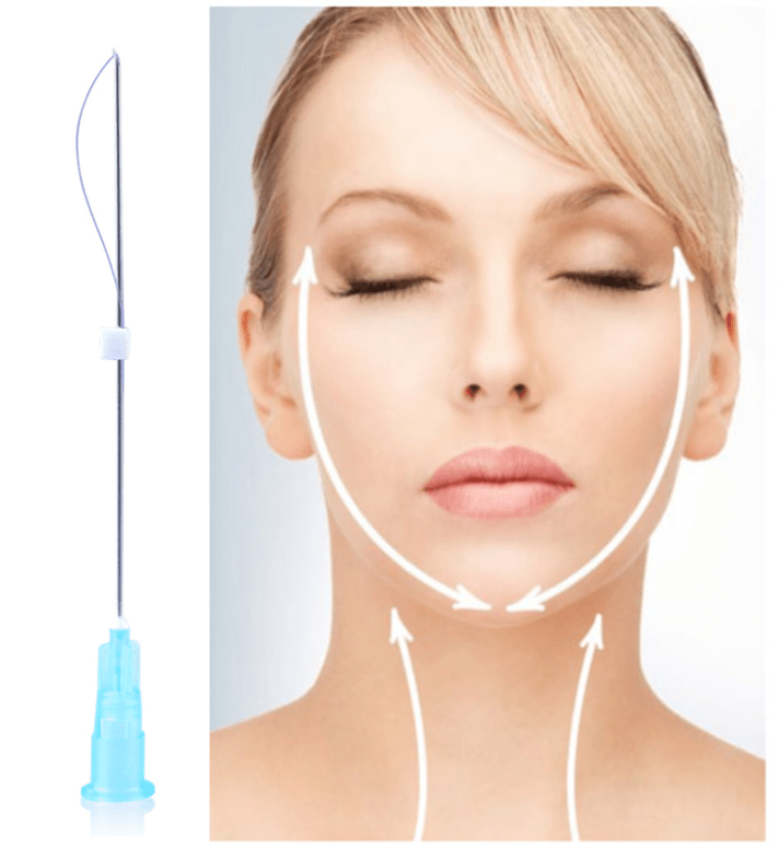 Thread Lift Irene's Skintopia