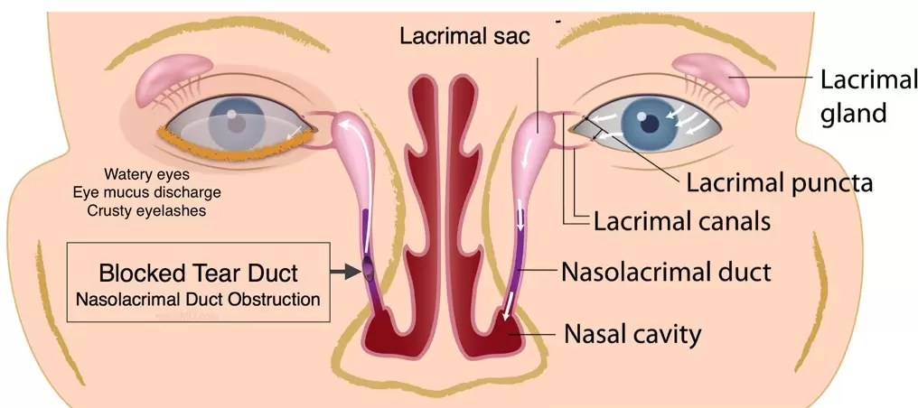 Pain In Corner Of The Eye Can Be A Symptom Of Dangerous Diseases | Iristech