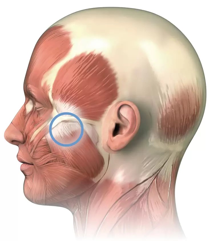 Muscles related to Pain in the Eye socket IrisTech