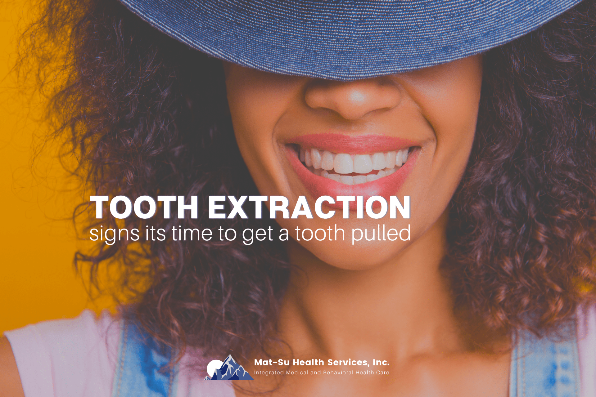 Signs It's Time To Get a Tooth Pulled