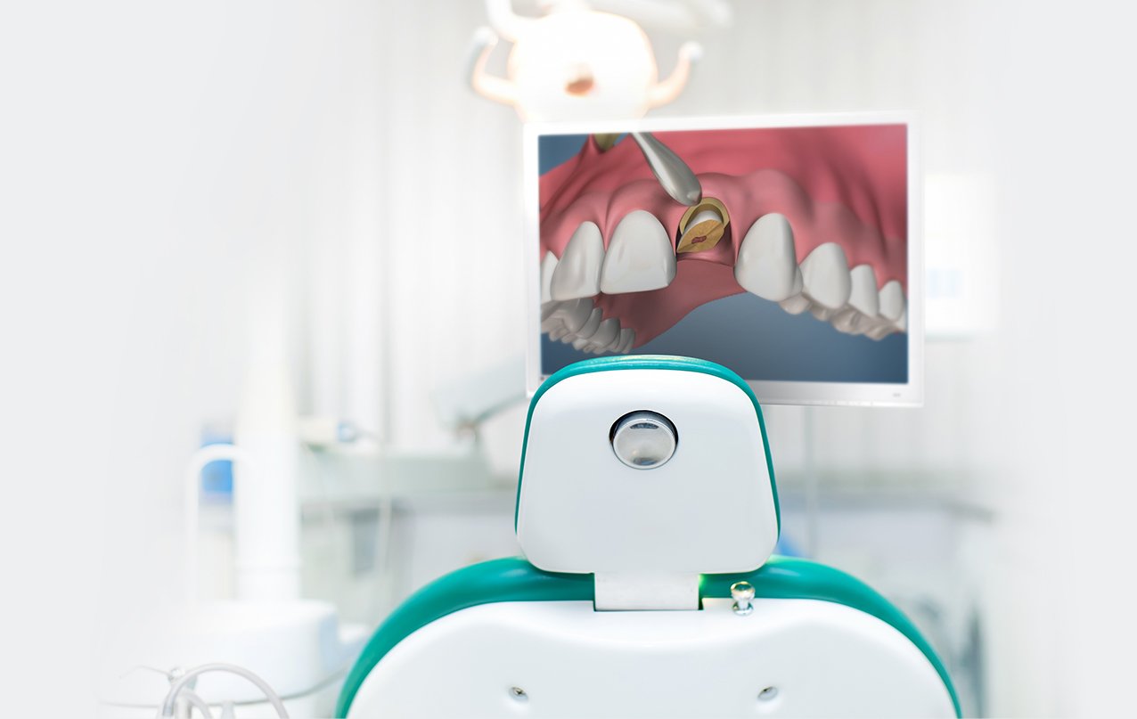 La mejor TECNOLOGÍA para el cuidado dental Dental Esthetic Solutions