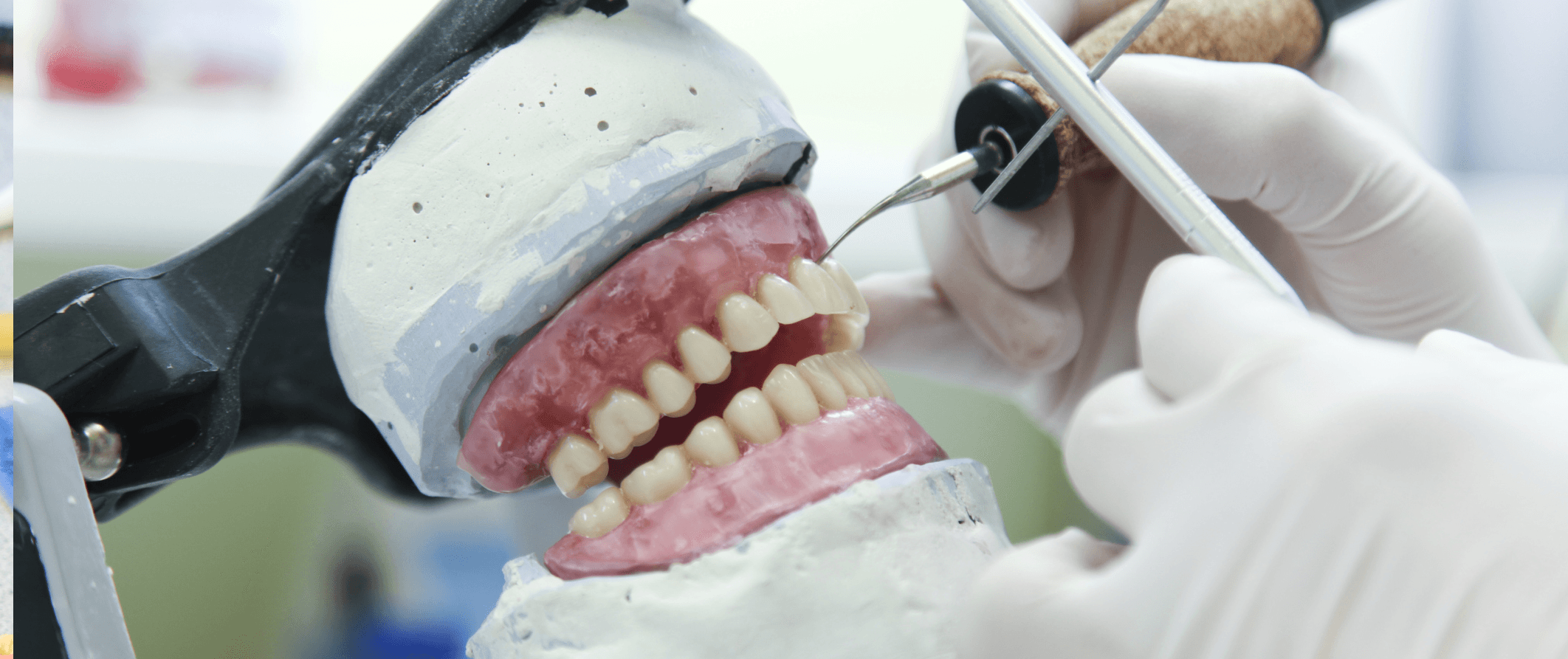 Dental Prosthesis Hobart Total Denture Care Clinics Total Denture